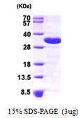 Human CHMP2A protein, His tag. GTX68402-pro