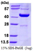 Human DCPS protein, His tag. GTX68421-pro