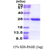 Human UBE2T protein, His tag. GTX68430-pro