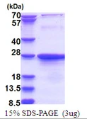 Human EXOSC1 protein, His tag. GTX68464-pro