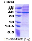 Human MRPS2 protein, His tag. GTX68475-pro