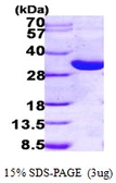 Human HSD17B14 protein, His tag. GTX68484-pro