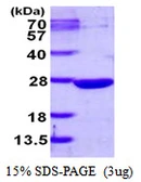 Human DUSP13 protein, His tag. GTX68486-pro