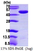 Human PPME1 protein, His tag. GTX68506-pro
