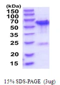 Human TBC1D22B protein, His tag. GTX68601-pro