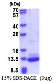 Human C3ORF10 protein, His tag. GTX68615-pro