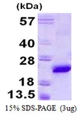 Mouse VPS29 protein, His tag. GTX68628-pro