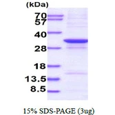 Human AADACL1 protein, His tag. GTX68662-pro