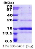 Human POLD4 protein, His tag. GTX68667-pro