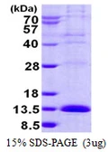 Human LSM2 protein, His tag. GTX68668-pro