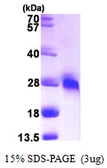 Human GGCT protein, His tag. GTX68720-pro