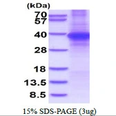 Human SPRY4 protein, His tag. GTX68773-pro