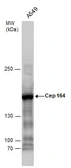 Anti-CEP164 antibody [17] used in Western Blot (WB). GTX70096