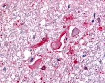 Anti-BRCA1 antibody used in Immunohistochemistry (IHC). GTX70134