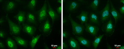 Anti-ID3 antibody [2B11] used in Immunocytochemistry/ Immunofluorescence (ICC/IF). GTX70201