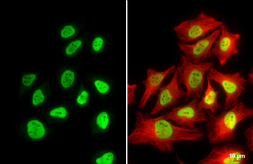Anti-RbAp48 + RbAp46 antibody [15G12] used in Immunocytochemistry/ Immunofluorescence (ICC/IF). GTX70236