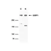 Anti-53BP1 antibody used in Western Blot (WB). GTX70316