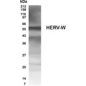 Anti-Human Endogenous Retrovirus antibody used in Western Blot (WB). GTX70327