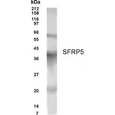 Anti-SFRP5 antibody used in Western Blot (WB). GTX70353