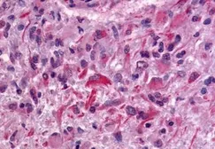 Anti-GPR64 antibody used in IHC (Paraffin sections) (IHC-P). GTX70515