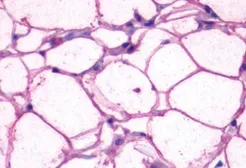 Anti-beta 3 Adrenergic Receptor antibody used in IHC (Paraffin sections) (IHC-P). GTX70685