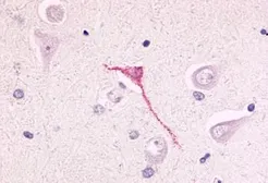 Anti-GPR17 antibody used in IHC (Paraffin sections) (IHC-P). GTX70687