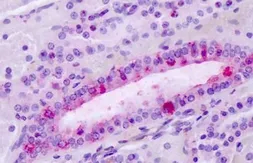 Anti-Latrophilin 3 antibody used in IHC (Paraffin sections) (IHC-P). GTX71183