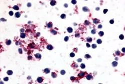 Anti-Prostaglandin I2 Receptor antibody used in IHC (Paraffin sections) (IHC-P). GTX71509