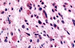 Anti-GABA B Receptor 1 antibody used in IHC (Paraffin sections) (IHC-P). GTX71591