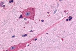 Anti-Dopamine Receptor D2 antibody used in IHC (Paraffin sections) (IHC-P). GTX71747