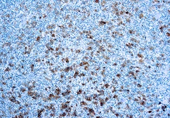 Anti-CD30 antibody [Ber-H2] used in IHC (Paraffin sections) (IHC-P). GTX71958