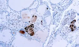 Anti-Calcitonin antibody (ready-to-use) used in IHC (Paraffin sections) (IHC-P). GTX73367