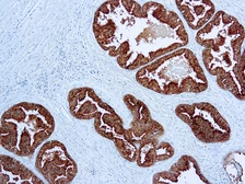 Anti-Prostatic Acid Phosphatase antibody [PASE-4LJ] (ready-to-use) used in IHC (Paraffin sections) (IHC-P). GTX73444