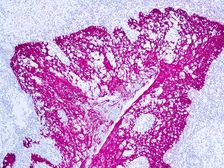 Anti-HMW Cytokeratin antibody [34βE12] (ready-to-use) used in IHC (Paraffin sections) (IHC-P). GTX73466