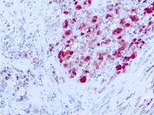 Anti-S100 antibody [SH-B1] (ready-to-use) used in IHC (Paraffin sections) (IHC-P). GTX73589