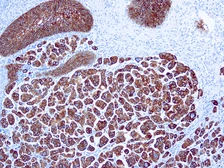 Anti-Cytokeratin 7 antibody [OV-TL 12/30] used in IHC (Paraffin sections) (IHC-P). GTX73668