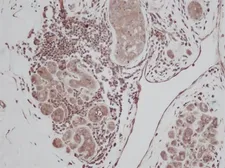 Anti-TGF alpha antibody used in IHC (Paraffin sections) (IHC-P). GTX74160