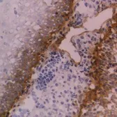 Anti-Integrin beta 4 antibody [450-9D] (Azide free) used in IHC (Frozen sections) (IHC-Fr). GTX75043