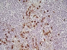 Anti-CD11b antibody [M1/70.15] used in IHC (Frozen sections) (IHC-Fr). GTX76473