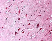 Anti-TGF beta antibody [TB21] used in IHC (Paraffin sections) (IHC-P). GTX76527
