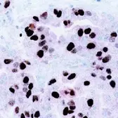 Anti-CENPF antibody [7F11.2] used in Immunohistochemistry (IHC). GTX77645
