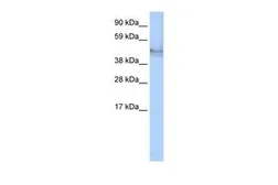Anti-Cytokeratin 14 antibody, C-term used in Western Blot (WB). GTX77740