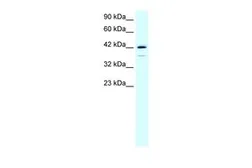 Anti-LIM1 antibody, C-term used in Western Blot (WB). GTX77778