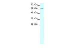 Anti-IVNS1ABP antibody, N-term used in Western Blot (WB). GTX77835