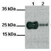 Anti-MYF5 antibody, N-term used in Western Blot (WB). GTX77867