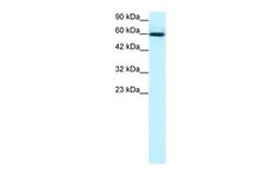 Anti-GABPA antibody, C-term used in Western Blot (WB). GTX77894