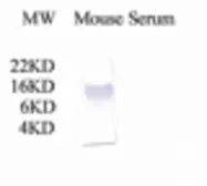 Anti-C3 / C3a antibody used in Western Blot (WB). GTX78199