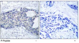 Anti-ZAP70 (phospho Tyr493) antibody used in IHC (Paraffin sections) (IHC-P). GTX78921