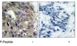 Anti-Src (phospho Tyr530) antibody used in IHC (Paraffin sections) (IHC-P). GTX78941