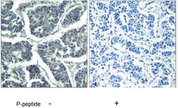 Anti-PLCG2 (phospho Tyr1217) antibody used in IHC (Paraffin sections) (IHC-P). GTX78961
